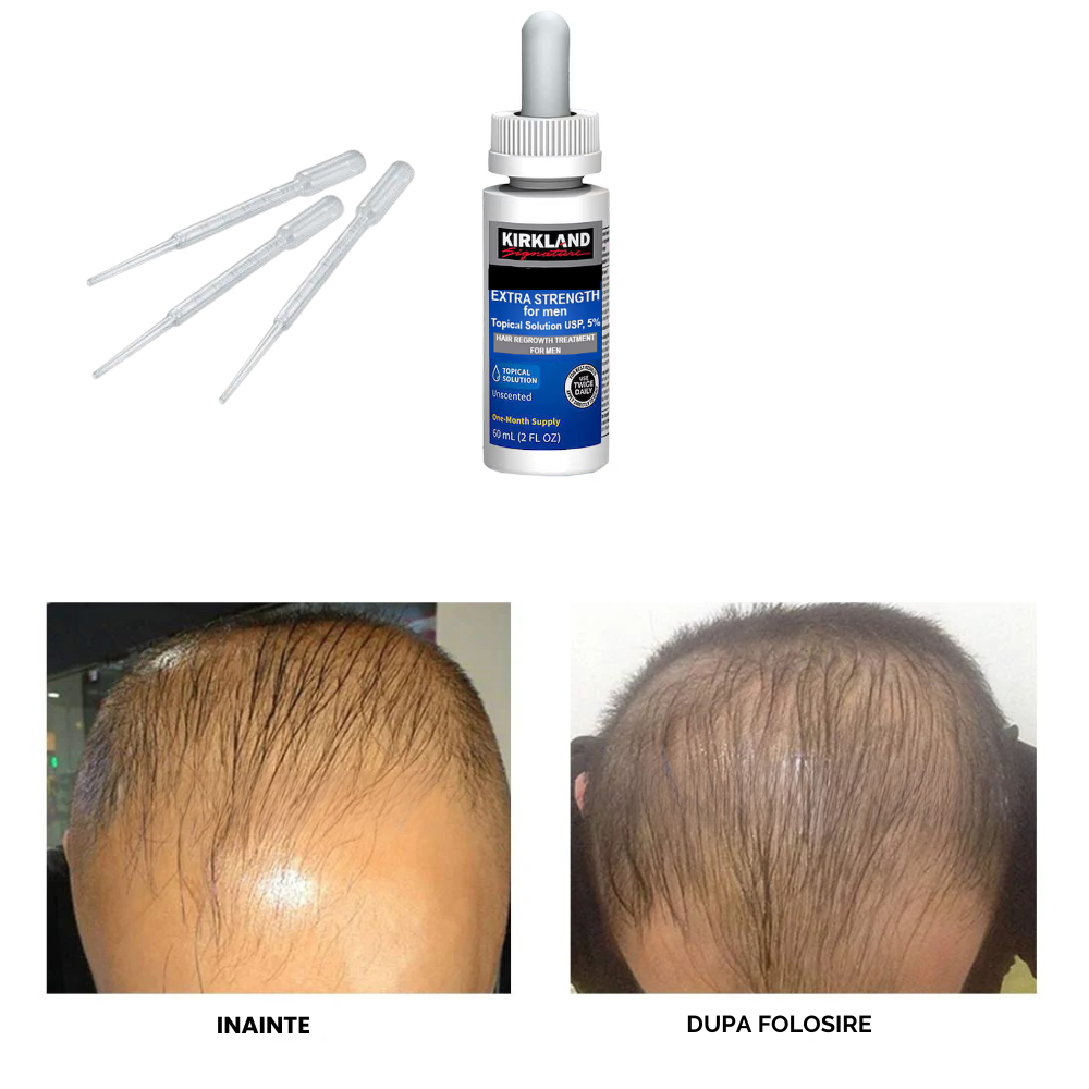 Set Tratament Minoxidil, KRK, 5%, pentru Stimularea Cresterii Parului si a Barbii, Pipeta Inclusa, 1 luna, 60ml