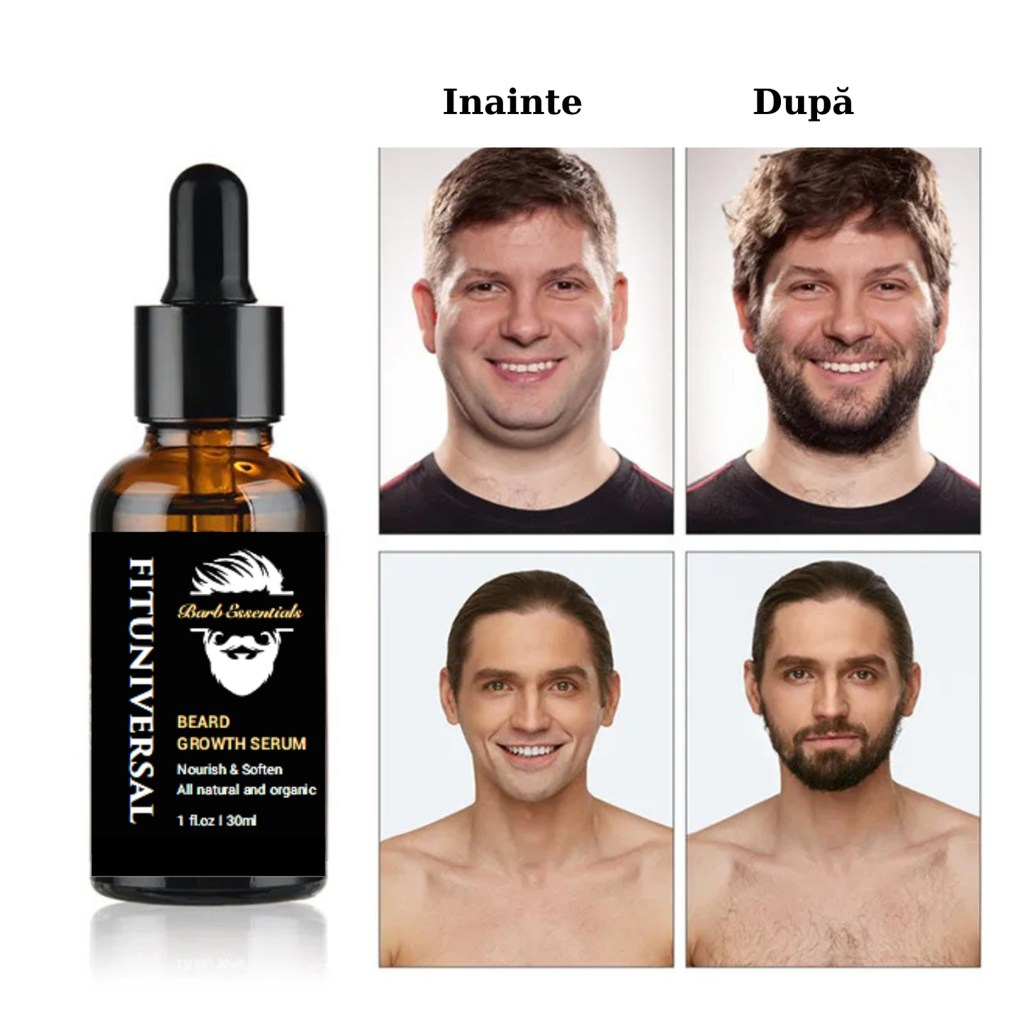 Set PREMIUM de crestere si ingrijire barba FITUNIVERSAL® din 4 piese avand inclus dermaroller, o crema si 2 uleiuri speciale pentru cresterea si netezirea firului de par, 60 ML