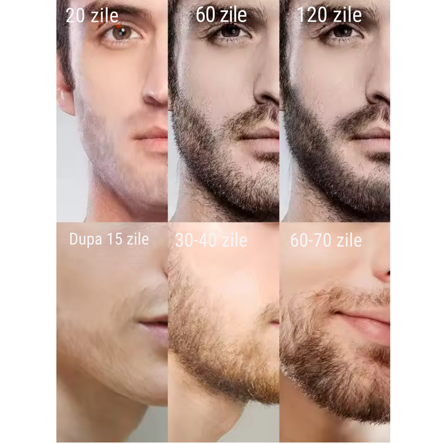 Set ulei si tratament pentru crestere si ingrijire barba FITUNIVERSAL® din 4 piese avand inclus derma roller, un ser si un ulei special pentru cresterea si netezirea firului de par, 180 ML