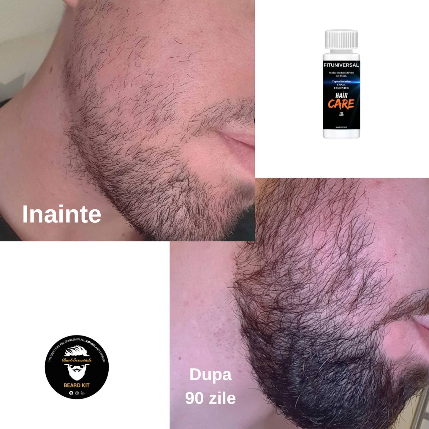 Set ulei si tratament pentru crestere si ingrijire barba FITUNIVERSAL® din 4 piese avand inclus derma roller, un ser si un ulei special pentru cresterea si netezirea firului de par, 180 ML