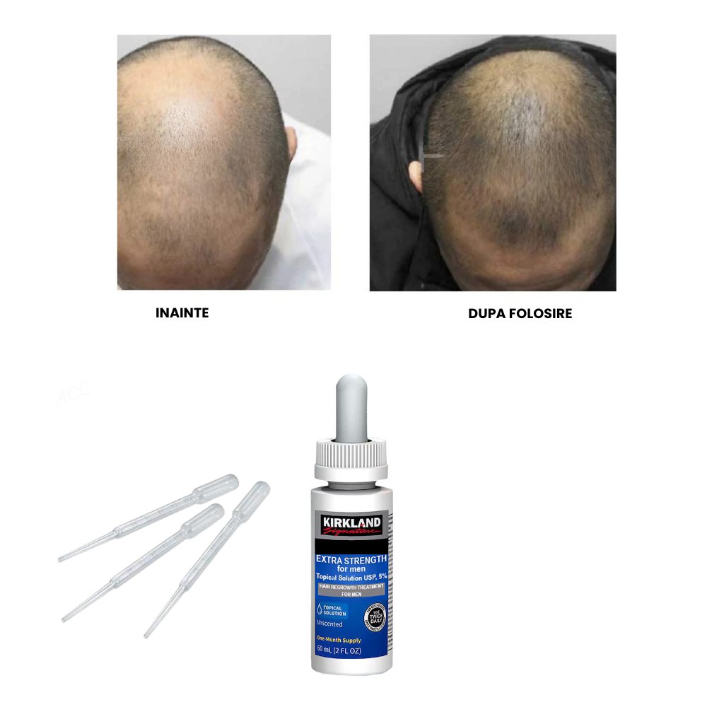 Set Tratament Minoxidil, KRK, 5%, pentru Stimularea Cresterii Parului si a Barbii, Pipeta Inclusa, 1 luna, 60ml