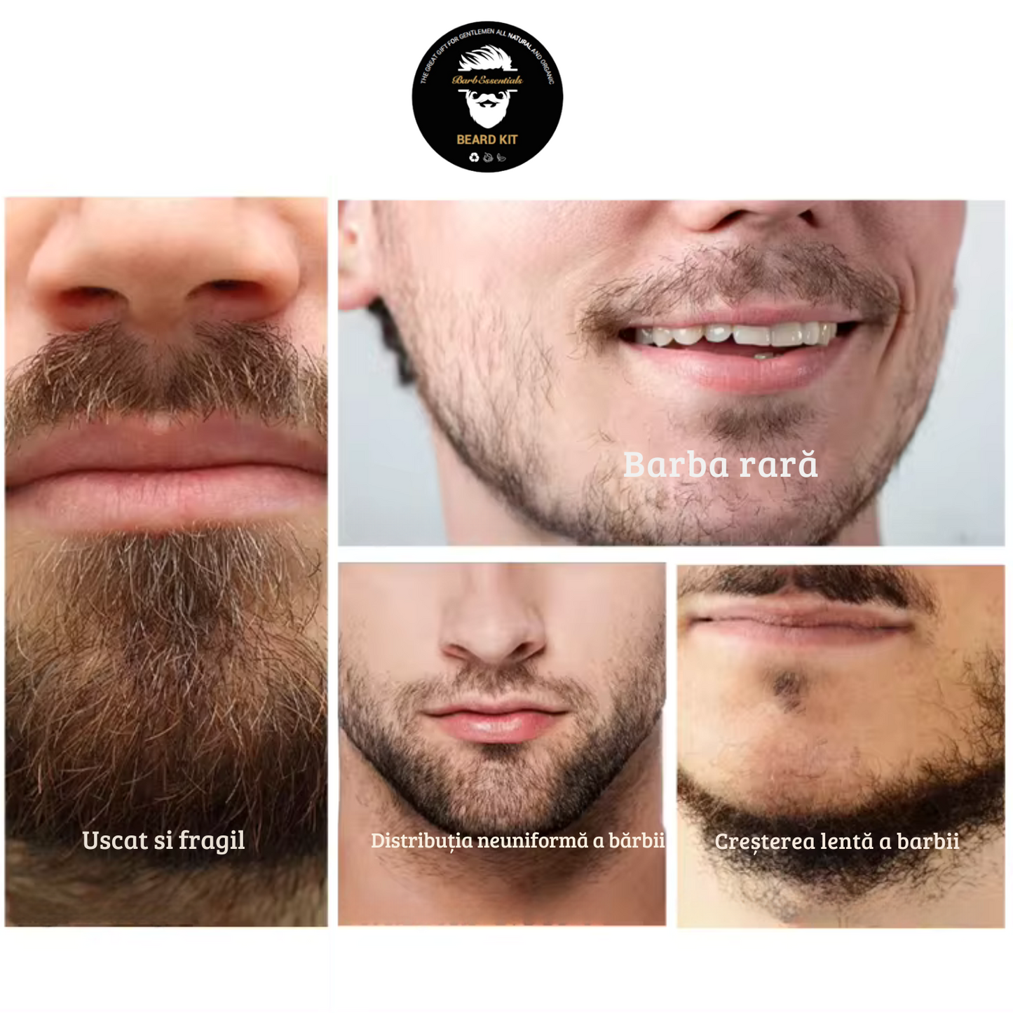 Set Minoxidil 2+1 GRATUIT tratament crestere si regenerare fire de par FITUNIVERSAL Minoxidil 5%, pentru 3 luni